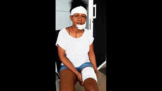  Debbie Kaore's injuries