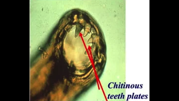 Microscope magnified view of hookworm mouth