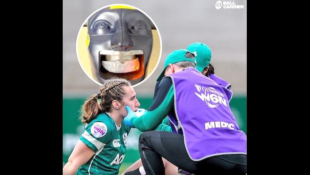 Mouth-guards that light up when a player sustains a significant head impact will be used at this year's women's Rugby World Cup, which starts next week. LED mouth guard