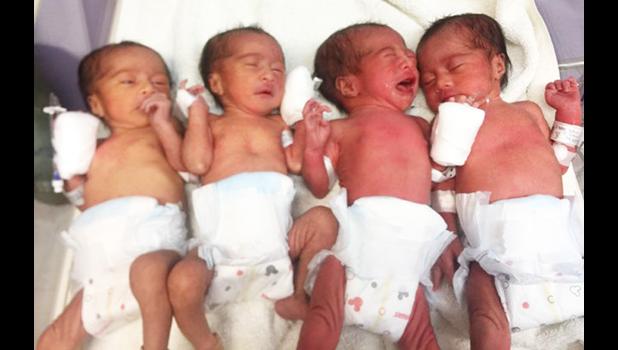 The quadruplets - all girls - who were delivered at the LBJ Hospital this past weekend.