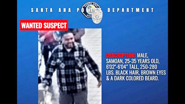 SANTA ANA ASSAULT SUSPECT