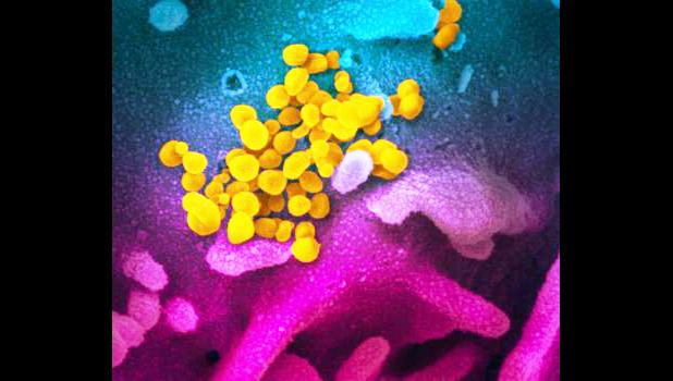electron microscope image of SARS-CoV-2