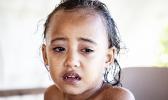 A child with measles, Serenity Vitale. (Photo: Misiona Simo) A child with measles