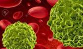 Cancer cells image
