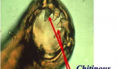 Microscope magnified view of hookworm mouth