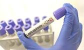 Leptospirosis test