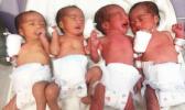 The quadruplets - all girls - who were delivered at the LBJ Hospital this past weekend.