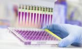 MCED tests may soon revolutionize the way clinicians approach cancer screening. The question is whether the health care system is ready for them. MCED tests may