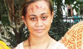 Toaipuapuagā Opapo-Ah Chong shows the signs of “stigmata” 