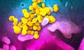 electron microscope image of SARS-CoV-2